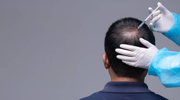 Hair Transplant Cost: How Much Should You Really Pay?