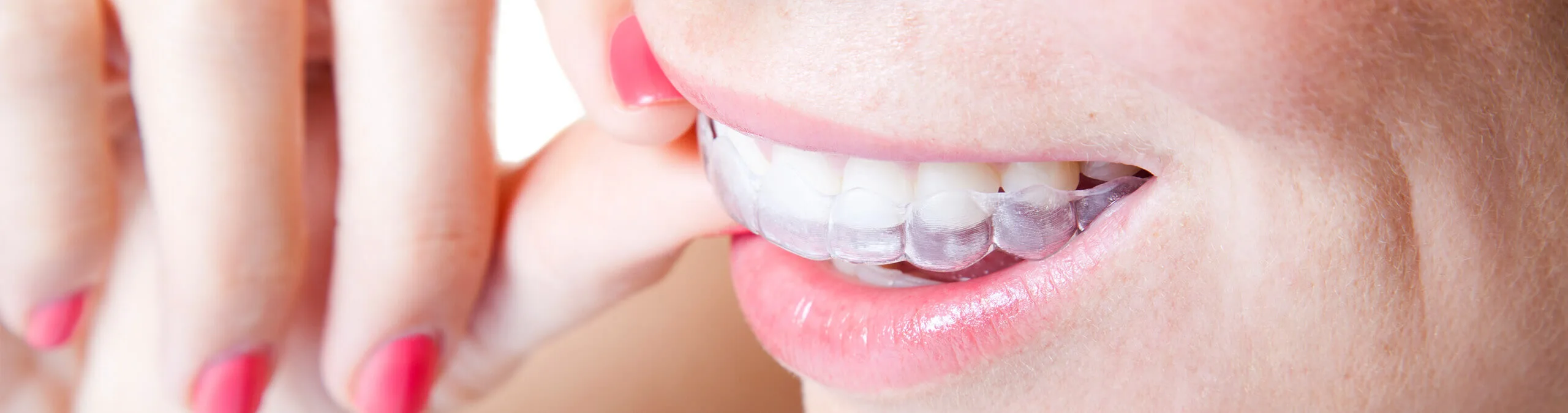 Why Choose the Best Dental Clinic in Chennai for Quality Care